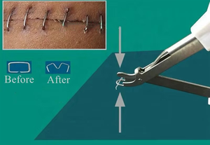 Pince extracteur de sutures chirurgicales jetables de qualité supérieure en acier inoxydable - Product Image 3