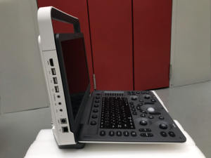 Équipement d'examen médical à bas prix sonoscape machine à ultrasons couleur Doppler portable E2 pour vétérinaire et humain - Product Image 2