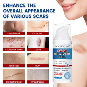 <span class=keywords><strong>Gel</strong></span> <span class=keywords><strong>de</strong></span> Eliminación <span class=keywords><strong>de</strong></span> <span class=keywords><strong>Cicatrices</strong></span> <span class=keywords><strong>de</strong></span> Marca Privada, el Más Rápido, Repara las Moretones, Reduce la Apariencia <span class=keywords><strong>de</strong></span> la Mayoría <span class=keywords><strong>de</strong></span> los Tipos <span class=keywords><strong>de</strong></span> <span class=keywords><strong>Cicatrices</strong></span>, 50 ml - Product Image 6