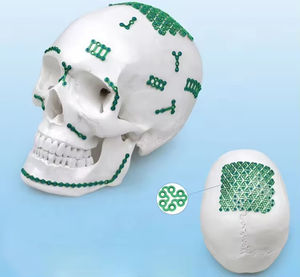 ชุดแผ่นไมโครสำหรับศัลยกรรมกระดูกและใบหน้า FIDA แบบกำหนดเอง รูปทรง DF สำหรับการปลูกถ่ายกระดูกและศัลยกรรมกระดูกและใบหน้า คู่มือการดูแลสุขภาพ - Product Image 4