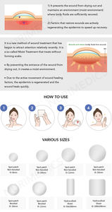 แผ่นไฮโดรคอลลอยด์แท้สำหรับรักษาสิวแผ่นแปะติดแผล70มม. แผ่นแปะสิวโลโก้ตามสั่ง100% - Product Image 5