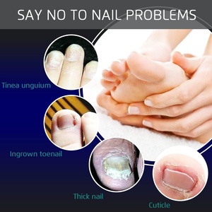 Nouvel ensemble de 4 instruments de podologie et de chiropodie : coupe-ongles manuel de haute qualité et durable - Product Image 6