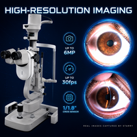 Dispositivo de Imagenología Oftálmica STARRY con Software para el Cuidado de los Ojos