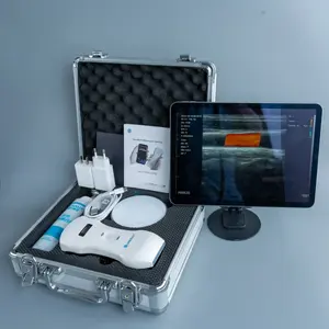 Suministro de Fábrica Suresult D3L 3 en 1 Ecógrafo Inalámbrico Portátil Doppler Color, Ecógrafo Móvil de 192 Elementos Lineales, DIY OEM ODM - Product Image 3
