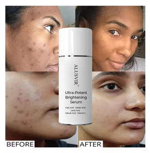 Oem pigmentasyon çil parlatıcı beyazlatma Anti-Aging yüz <span class=keywords><strong>Serum</strong></span> cilt bakımı beyazlatıcı koyu nokta kaldırma düzeltici <span class=keywords><strong>Serum</strong></span> yüz - Product Image 1