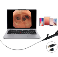 Vente chaude, fourniture professionnelle, système d'endoscopie vétérinaire, bronchoscope, appareil d'imagerie médicale flexible
