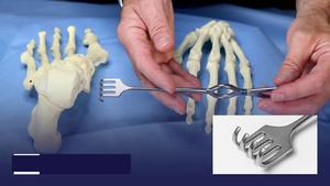 Retractor manual Volkmann Catspaw con fuente de energía, de acero inoxidable fino, para cirugía espinal, instrumento quirúrgico Clase I, Set 1 - Product Image 2