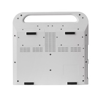 Appareil d'échographie portable RS-N50 et scanner d'échographie BW économique avec batterie