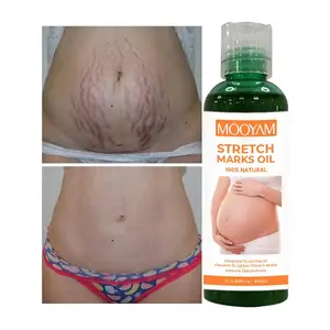 Strong Effective Stretch Mark Oil Postpartum Repair Firming Skin And Remove Stretch Mark Essential Oil