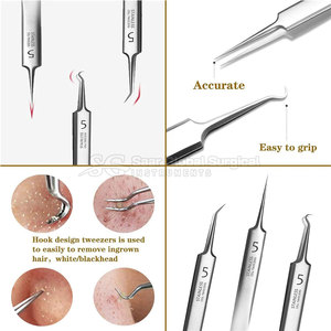 Kit Profesional de Extracción de Puntos Negros de Acero Inoxidable SAAR GLOBAL SURGICAL SGS-902 para un Acabado Suave en la Piel, Cuidado Confiable de la Piel - Product Image 3