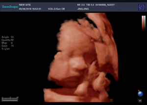 Hot Selling Trolley Medische Echografie-apparaat Sonoscape P15 met een lage prijs - Product Image 4