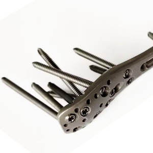 Rétracteur manuel Norfolk Norwich de qualité supérieure en acier inoxydable robuste, cadre extra-résistant, chirurgie générale - Product Image 4