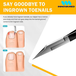 Straight Blade Toenail Clippers for Thick Toenails Wide Open <b>Pointed</b> Jaw <b>Toe</b> Nail Clippers High Precision Podiatry Pliers - Product Image 4