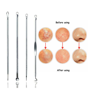 ชุดกำจัดสิวหัวดำสแตนเลสใช้ซ้ำได้เครื่องมือด้านความงามแบบตั้งโต๊ะดีไซน์ใหม่ - Product Image 2