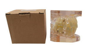 Modèle orthodontique 24 pièces sans bracket, modèle d'étude dentaire, démonstration orthodontique pour la pratique et l'enseignement en dentisterie - Product Image 5