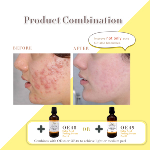 Correcteur de taches brunes à l'acide de canne à sucre 35% - Gel exfoliant pour le visage et le corps - Blanchissant - Anti-rides - Anti-âge - Product Image 4