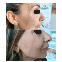Suero Facial Líquido con Vitamina C, Glicerina y Ácido Hialurónico, Antienvejecimiento, Blanqueador y Reductor de Poros, Listo para Enviar, Fabricante Italiano