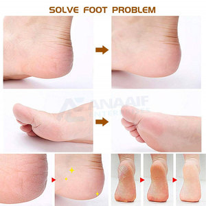 Nouvel arrivage Coupe-ongles en acier inoxydable de haute qualité Ensemble d'instruments de beauté durables pour manucure et pédicure - Product Image 3