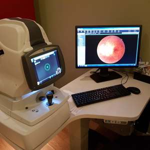 Nuevo OCT RS-330 Retina Scan Duo 2, Cámara de Imagen de Retina Automática No Midriática, Tomografía de Coherencia Óptica OCT RS-330 - Product Image 2