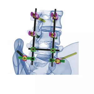 Juego de instrumentos ortopédicos para implantes vertebrales de uñas intramedulares, instrumentos quirúrgicos, manual de acero hecho en Pakistán - Product Image 3