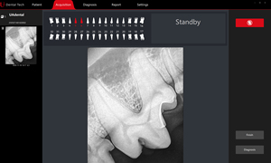 جهاز أشعة سينية محمول كامل على شكل مسدس مع مستشعر للتصوير، معدات للاستخدام في طب الأسنان والطب البيطري - Product Image 4
