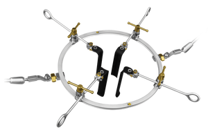 Juego de retractor lumbar anterior ALTM OEM, instrumentos ortopédicos de cirugía de columna vertebral de calidad superior, productos aprobados por CE - Product Image 3