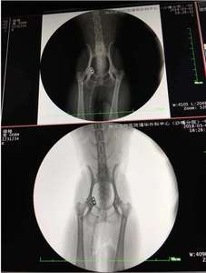 آلة تنظير الذراع PFD C لجراحة الأشعة مع نظام ذراع رقمي C جهاز أشعة <span class=keywords><strong>X</strong></span> - Product Image 5