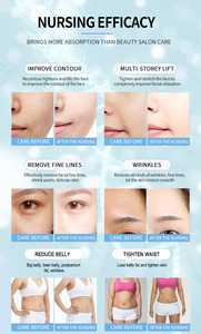 2027 Good Price 22D MAX <b>Beauty</b> <b>Equipment</b> Machine for Facial Tightening Slimming and Fat Reduction Latest Model - Product Image 5