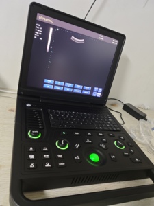 Échographe vétérinaire portable sans fil pour bovins, chevaux, chiens, chats, porcs, moutons et diagnostic de gestation animale - Product Image 2