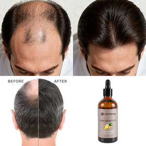 Set Biologico per la Crescita dei Capelli all'Ingrosso, Shampoo e Balsamo Naturale al Miglior Zenzero Vecchio per la Crescita dei Capelli e Contro la Caduta - Product Image 3