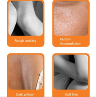 Eternalelinor Huile de peeling jaune personnalisée Anti-âge et anti-vergetures Lotion pour le visage Huile de peeling en gros extra forte