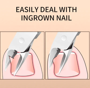 กรรไกรตัดเล็บ anaif สแตนเลสแบบสปริงคู่สำหรับนิ้ว - Product Image 6