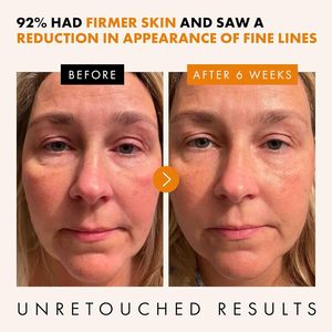 Suero <span class=keywords><strong>facial</strong></span> de vitamina <span class=keywords><strong>C</strong></span> ácido hialurónico ácido ferúlico <span class=keywords><strong>Vit</strong></span> E suero iluminador <span class=keywords><strong>Facial</strong></span> para el cuidado de la piel - Product Image 2