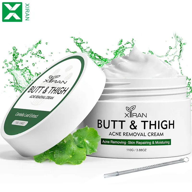 Natuurlijke Organische Centella Asiatica Puistjes Acne Behandeling Gezichtscrème Hydraterende En Reparatie Butt Dijlichaam Anti Acne Crème