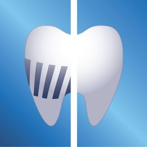 Cabezales de Repuesto Originales Philips Sonicare Premium para el Cuidado de las Encías, Paquete de 2, Negro - HX9052/33 - Product Image 4