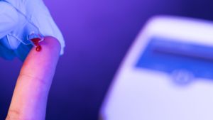 ANALIZADOR DE HEMOGLOBINA Clase II para Desinfección con Alcohol - Product Image 3