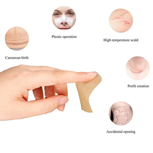 Échantillon gratuit de produits de soin de la peau pour l'élimination des cicatrices d'acné, traitement des cicatrices, gel, ruban adhésif pour les cicatrices - Product Image 3