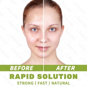 פרטי תווית אקנה הורמונלית תוספת עמום טבעי-העור טיפול ויטמינים קפסולות - Product Image 3