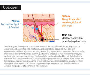 Épilateur laser Superlaser SL 755/808/1064nm pour l'épilation, 2400W, refroidissement par eau/air/saphir, usage commercial - Product Image 3