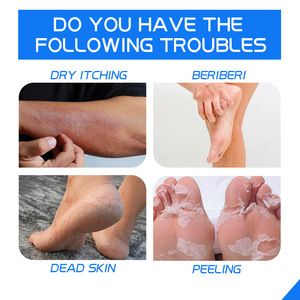 Crema Hidratante, Lápiz Labial Profesional para Reparación de Grietas, Apto para Talones de Zapatos Secos y Agrietados. - Product Image 4