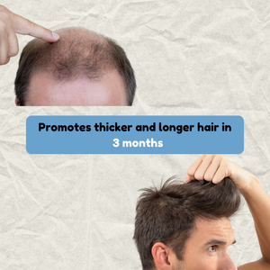 Dermatólogo-Formulado Hombres Crecimiento del cabello Impulsar el crecimiento del Berro Botella Producto de cuidado personal para adelgazar el cabello - Product Image 5