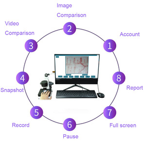 Kính hiển vi phân tích vi tuần hoàn di động quan sát lưu lượng máu và hình Thái mạch máu cho các phòng khám và trung tâm y tế - Product Image 3