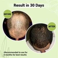Poudre de D-Biotine (Vitamine B7) de marque TXJ pure à 98 %, taille de particules 80 Mesh, pour produits cosmétiques et produits de croissance capillaire, certifiée ISO