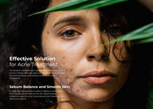 Masque thermique à l'argile TTO, 12 pièces, formule à l'huile d'arbre à thé, nettoyage en profondeur aux herbes, renouvellement de la peau, apaisant, hydratant, soin du visage pour tous les types de peau - Product Image 6