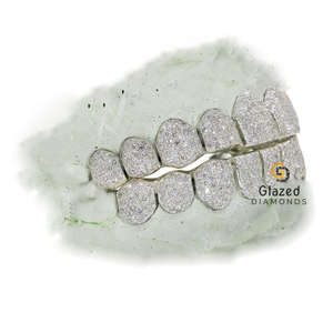 Joyería de moda Hip Hop 925 plata esterlina moissanita corte brillante redondo diamante personalizado Grillz para Unisex con claridad Vvs - Product Image 3