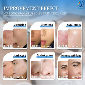 Máquina de Belleza Portátil Hydra AI 12 en 1 para Salón Limpieza Facial Profunda y Cuidado de <span class=keywords><strong>Ojos</strong></span> con Analizador Enchufe EU/US/IT/ZA Uso Comercial Pantalla Táctil - Product Image 6