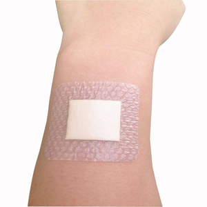 सीई गर्म बेच चिकित्सा Npwt ड्रेसिंग किट ड्रेसिंग डिस्पोजेबल Npwt ड्रेसिंग फोम - Product Image 6