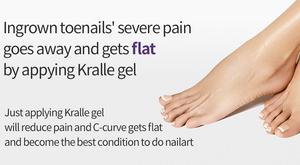 Kit de soin des ongles en gel pour ongles incarnés, application facile, traitement réparateur, gel coréen - Product Image 5