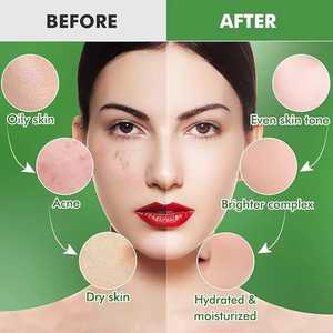 2025มาใหม่คุณภาพสูง650ก. เดอร์มาใหม่สำหรับมาสก์หน้าแป้งไฮโดรเจลลี่มาตรฐานสำหรับกำจัดสิวและรอยแผลเป็น - Product Image 4