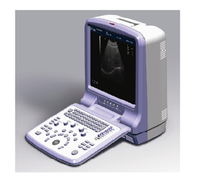 Draagbare Kleur Ultrasone Scanner Met Hoge Resolutie Beeldvorming Voor Veelzijdige Klinische Toepassingen En Real-Time Diagnostiek - Product Image 1
